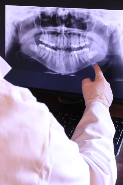 Best Cracked Tooth Emergency Dentist  in Belmont, PA