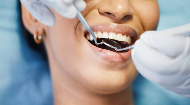 Best Knocked-Out Tooth Emergency  in Belmont, PA