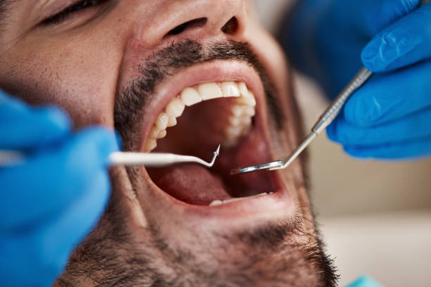 Best Dentist for Dental Trauma  in Belmont, PA